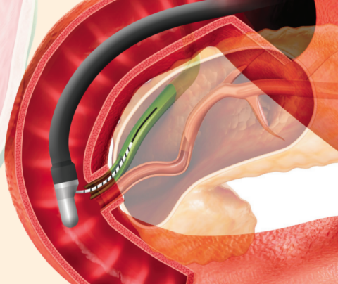 성원메디칼, ERCP Guide Wire ‘TRU WIRE’ 수출 확대… 500만달러 규모 성장 목표