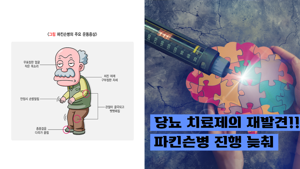 제2형당뇨병치료제 파킨슨병 속도를 늦추다
