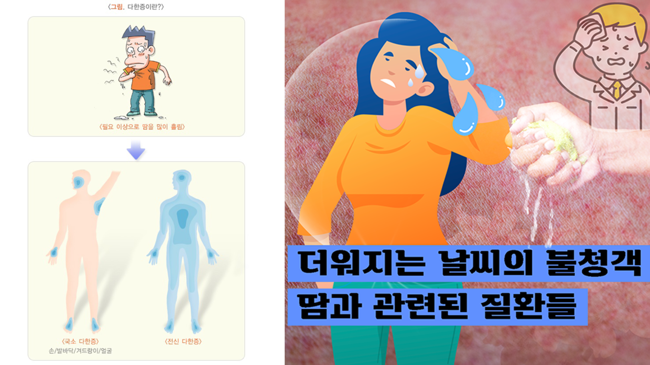 땀원인부터 질환까지 확실하게 파보자