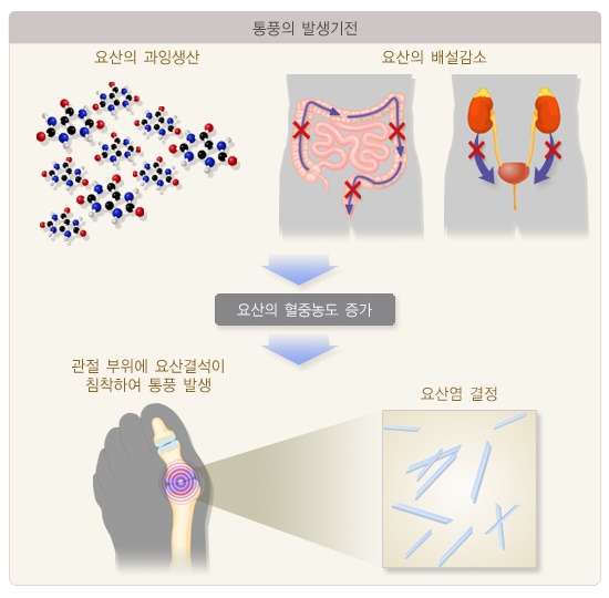 출처 : 질병관리청 국가건강정보포털