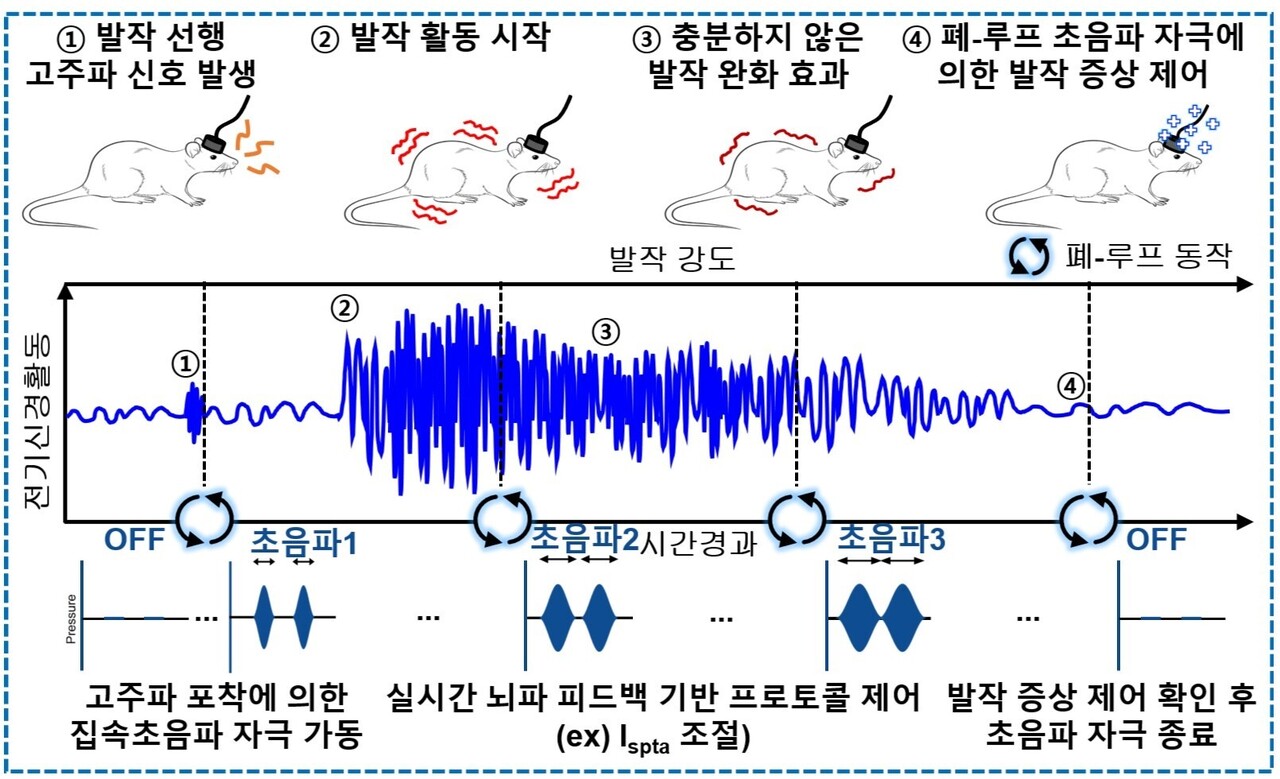 전자약 시스템은 형상변형 대뇌피질접착 신축성 전자패치와 소형 경두개 집속초음파 변환기로 구성된다. 먼저, 쥐의 머리에 전자패치를 부착하고 소형 경두개 집속초음파 변환기를 이식해, 무손실 대뇌피질전도 피드백 폐-루프 발작 제어가 가능하도록 전자약 시스템을 구성했다. 그리고 뇌전증을 유발한 쥐를 대상으로 16채널 전자패치를 이용해 대뇌피질전도를 실시간으로 모니터링했다. 고품질 뇌파 측정은 집속초음파 전자약의 3단계 강도 변조 중에도 안정적으로 가능했으며, 폐-루프 뇌전증 제어를 성공적으로 달성했다. / 출처 : 기초과학연구원