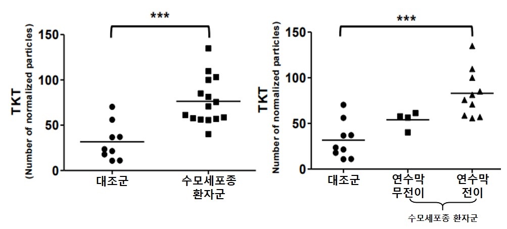 TKT 양성 세포외소포 개수 비교. 수모세포종 환자군은 대조군보다 TKT 양성 세포외소포의 개수가 많았고(왼쪽), 연수막 전이 그룹은 무전이 그룹보다 TKT 양성 세포외소포의 개수가 많았다(오른쪽) / 출처 : 서울대병원