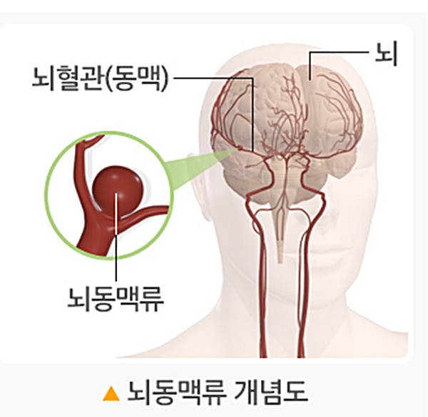 출처 : 국가건강정보포털