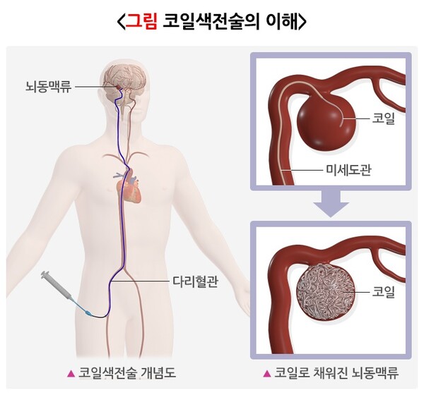 출처 : 국가건강정보포털