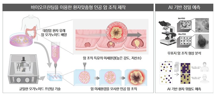 환자 맞춤형 인공 암 조직 바이오프린팅과 이를 기반으로 하는 환자 예후 예측 AI / 출처 : UNIST
