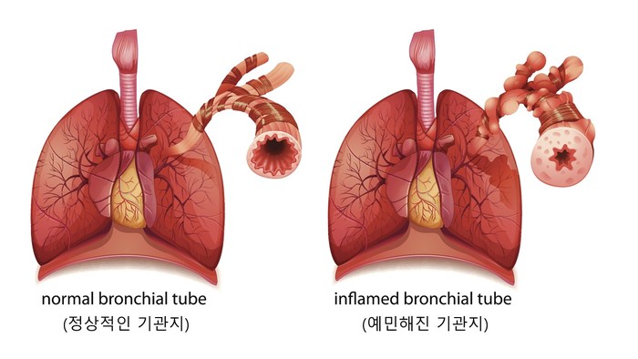 제공 : 서울대학교병원