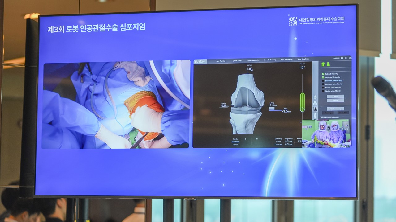 제공 : 부민병원