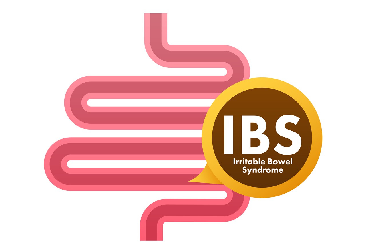 과민성 대장 증후군(IBS)과는 초기 증상이 비슷해 혼동할 수 있지만, 정확한 구분이 필요하다 / 이미지 출처 : Motion Elements