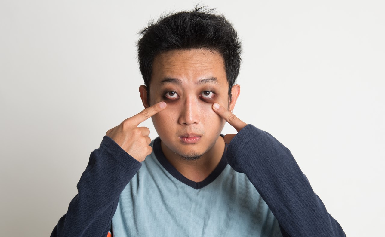 다크서클 자연 치유법, 두 가지 주된 이유와 습관 개선